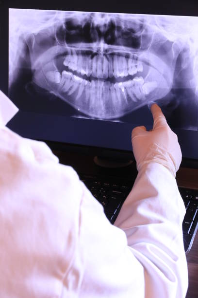 Emergency Dental Filling Replacement in MI