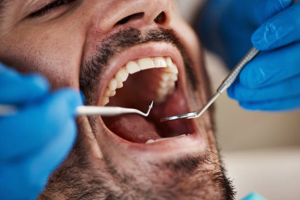 Best Affordable Emergency Dental Care  in St Clair, MI
