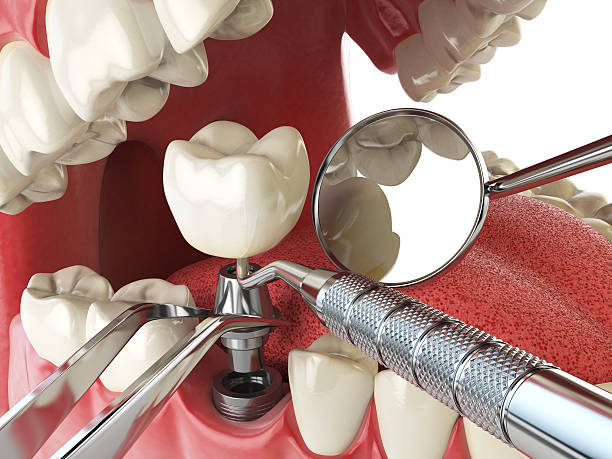 Best Root Canal Emergency Dentist  in St Clair, MI